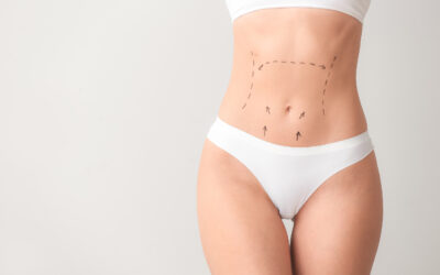 How to Afford a Tummy Tuck in Houston, TX: 3 Smart Financing Tips